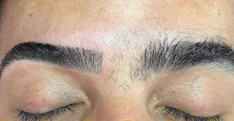 Texturierter Oberkopf